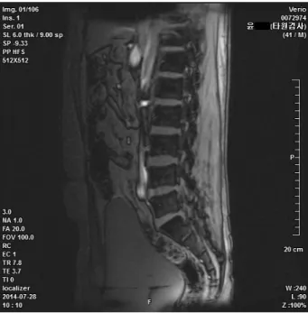 Fig.  1.  L4-5  Axial  Image  of  L-spine  MRI. Fig.  3.  Sagittal  Image  of  L-spine  MRI.