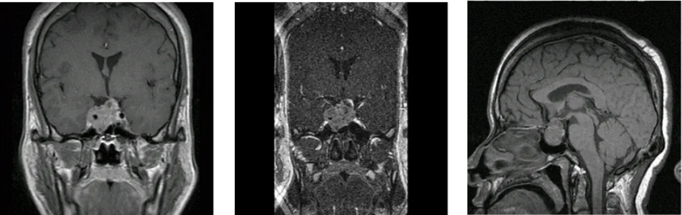 Fig.  3.  Abdominal  CT