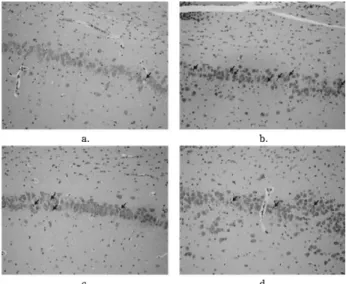 Fig.  8.  The  immunohistochemical  finding  on  Tau  expression  on  hippocampus  (×200,  21  days,;  (a)  groupI,  (b)  group  II,  (c)  group  III,  (d)  group  IV).