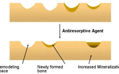 Fig.  6.  Effects  of  antiresorptive  agent  on  remodeling  space  and  mineralization  in  the  basic  multicellular  units.
