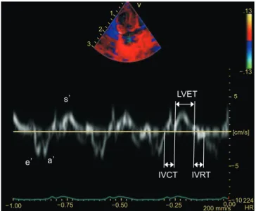 Fig. 1. Tissue Doppler imaging at basal portion of right ventricle (RV)  in pulmonary arterial hypertension (PAH) rat model
