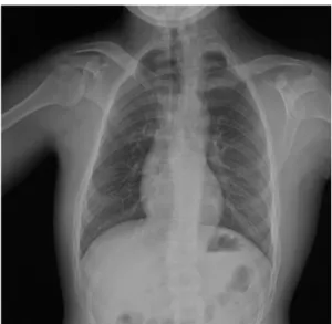 Fig. 1. Chest radiograph.
