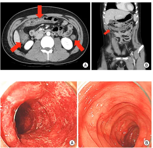Fig. 1. Abdominal computed tomography. 
