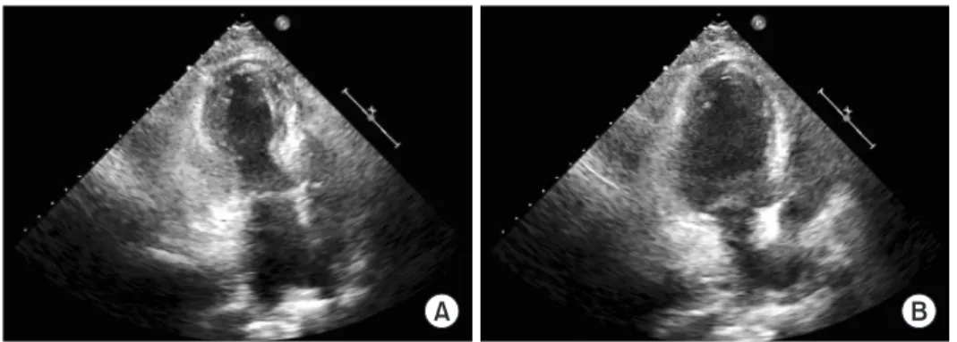 Fig. 1. Electrocardiogram (ECG). (A) ECG obtained two years ago shows sinus rhythm with left ventricular hypertrophy