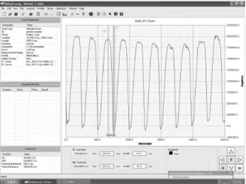 Fig. 12 Measured data of a plastic screw profiles    4.2  나사산간의  피치정밀도  분석  제작된  나사부의  나사산간  피치정밀도를  고찰하 기  위해  3 차원  표면측정기를  사용하여  나사산  프 로파일을  측정하였다