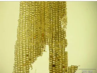 Figure 3. Tangential section of Pinus spp..