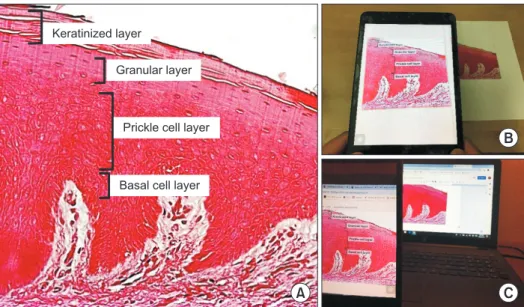 Figure 3.   Running and testing the augmented reality (AR) application on an iOS device