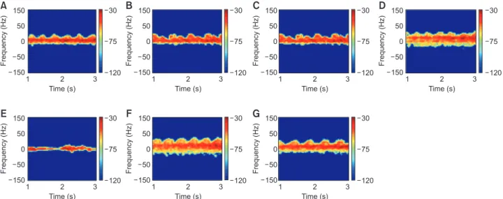 Figure 5.   Augmented micro-Doppler image using generative adversarial networks: (A) boxing while moving forward, (B) boxing while  standing in place, (C) crawling, (D) running, (E) sitting still, (F) walking, and (G) walking hunched over while holding a s