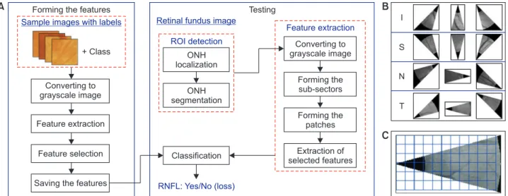 Figure 2.   Stage diagram of the proposed retinal nerve fiber layer (RNFL) detection method