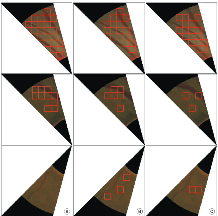 Figure 5.   Comparison of retinal nerve fiber layer detection result obtained using three different classifiers: (A) backpropagation neu- neu-ral network, (B) support vector machine, and (C) k-nearest neighbor.