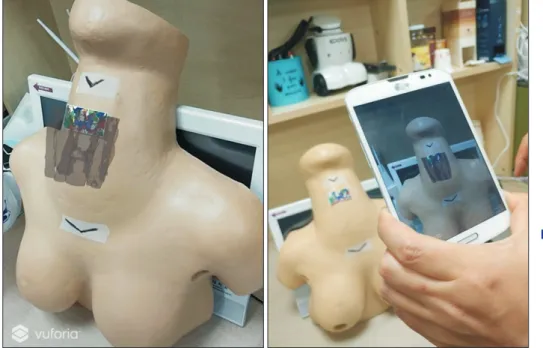 Figure 9.  Example of application of  augmented reality  tech-nology: thyroid and  in-ternal organs on a robotic  thyroidectomy training  model through a  smart-phone display.