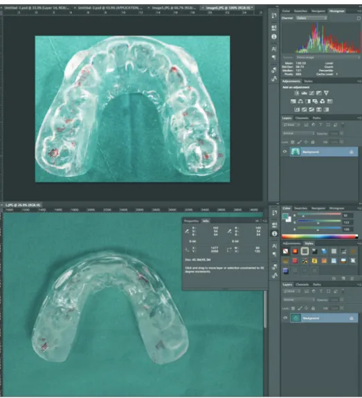 Figure  1.    The  digital  measurements  of the size in pixels and  the colors in red (R), green  (G), and blue (B) of the  ar-ticulating paper markings  on canine-protected hard  stabilization splints were  recognized using Adobe  Photo shop software (Ad