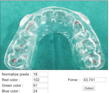 Figure 4.   The occlusal force prediction of one articulation paper  marking using the digital values of size in pixels and  color in the RGB mode.