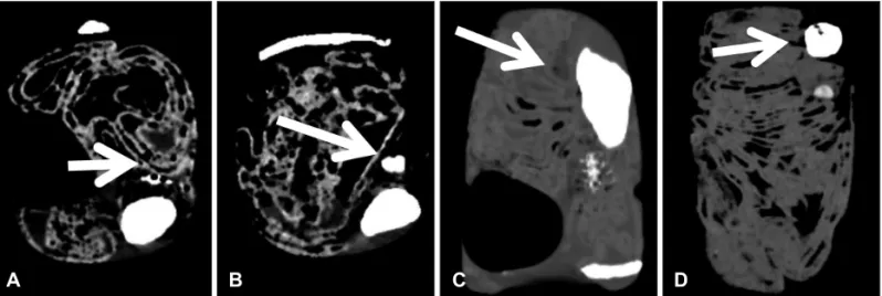 Fig. 4. Basic computed tomogram of the foreign body model Axial (A, B) and sagittal view (C, D)