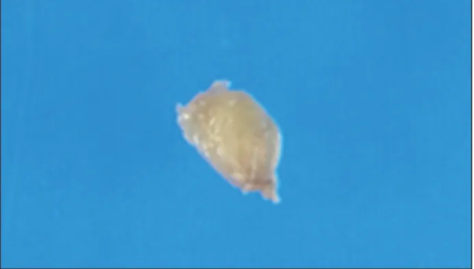 Fig. 3. Gross appearance of the excised mass. The specimen consists  of an encapsulated light yellowish rubbery mass, 12 × 7 × 5 mm in size.