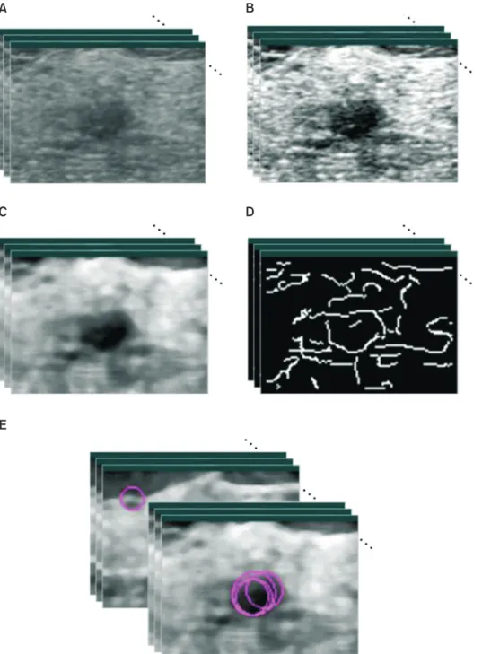 Figure 1. Illustration of pre-process- pre-process-ing steps on 3D US images. 