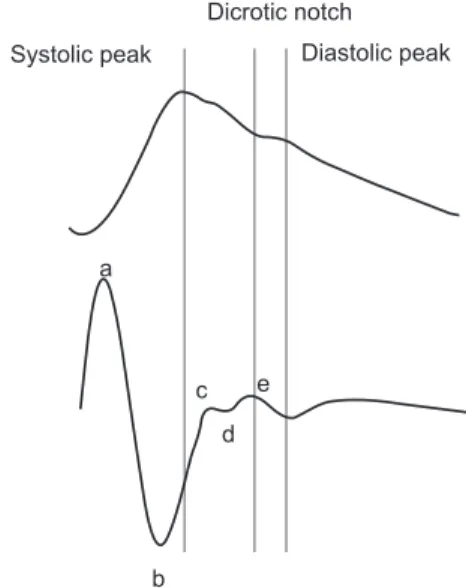 Figure 1. (Top) Original fingertip photoplethysmogram waveform. 