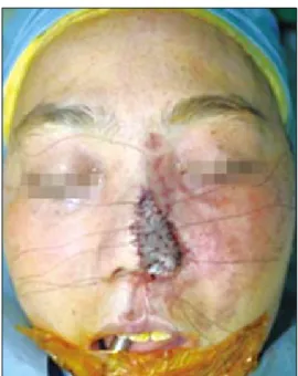 Fig. 4.  Follow-up after 6 months.