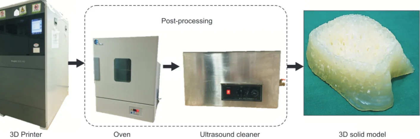 Figure 2. Process from computed tomography (CT) image acquisition to the production of a 3D file, comprising four major steps: image  is acquired from CT and raw CT data image is achieved, image segmentation is performed in image post-processing and a 3D  