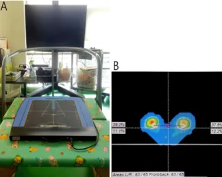 Figure  1. Balance measuring instrument A:  Biorescue,  B:  Buttock  pressure  in  Biorescue 