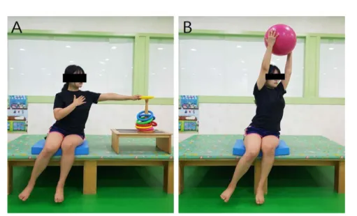Figure  2.  Intensive weight shift training for intervention A:  Putting  a  ring,  B:  Throwing  &amp;  catching  a  ball
