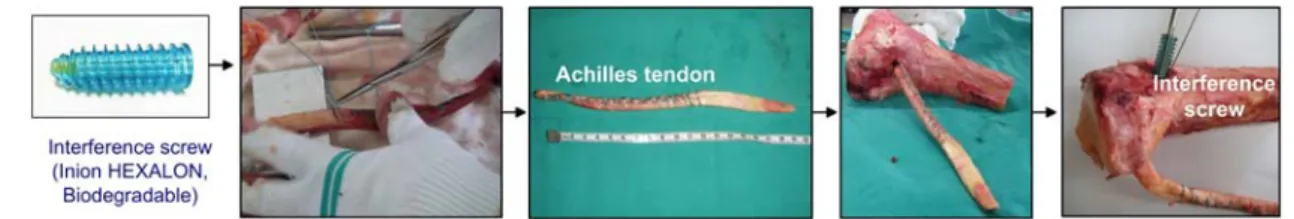 Fig. 2 Preparation of fresh frozen cadaver tibia specimen classed by (a) PCL reconstruction with  interference screw (Inion Hexalon, Poly Lactic Acid (PLA)); (b) PCL reconstruction with  bio-absorbable double cross-pins (RIGIDFIX_2.7 mm BTB CROSS PIN KIT, 