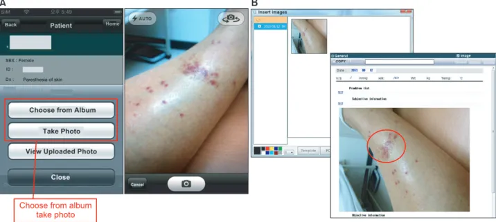 Figure	8.	Healthcare	providers	can	ea	sily	transfer	and	edit	images	via	smartphone	camera	by	Mobile-Ulsan	University	Hospital	Medical	 Information	System	(M-UMIS).	(A)	Patient	images	on	smartphone,	(B)	transferred	images	by	M-UMIS