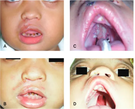 Figure 5. Postoperative view.