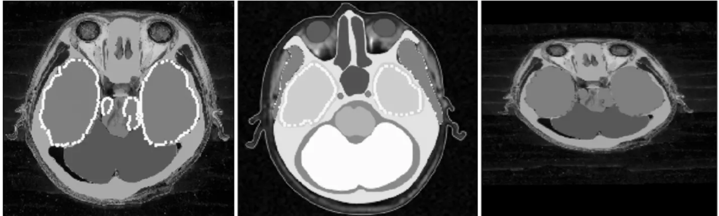 Figure 4. Inadequate automatic registration based on cerebrum. Segmented sectioned image (left) and segmented MRI (center) with  dots pointed on the cerebrum registered segmented sectioned image (right)