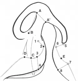 Figure 1. Schematic drawing of landmarks identification  before FCR. A. the upper corner of the healthy nostril,  A'