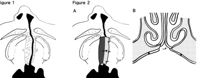 Figure 1 Figure 2