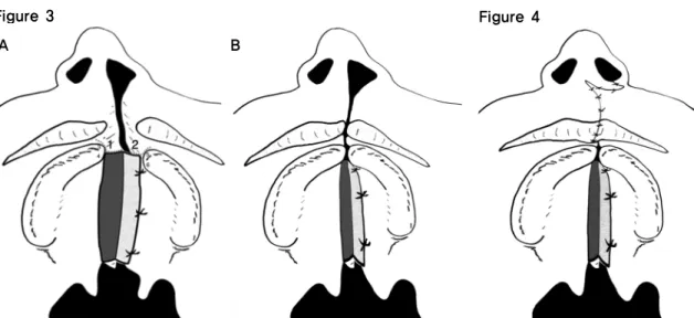 Figure 3 Figure 4