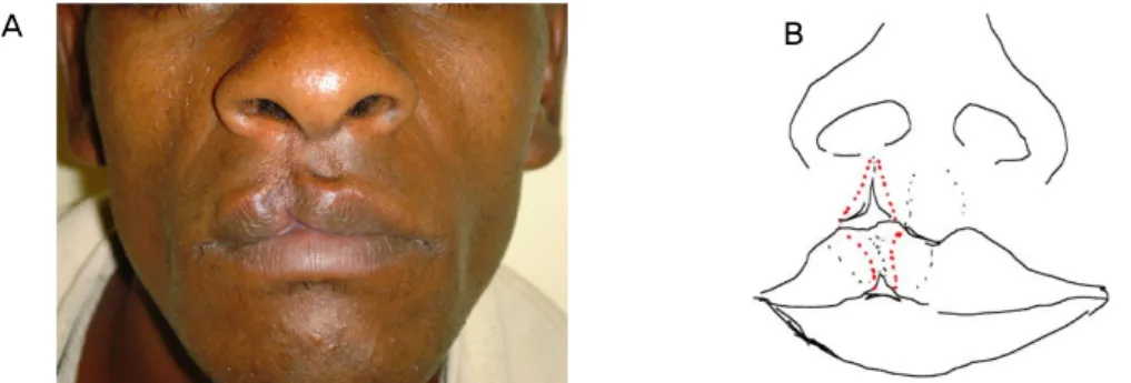 Figure 1. Anatomical landmarks showed minimal distortion and sufficient soft  tissue  without  vertical  shortage