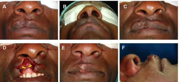 Figure 2. Intraoperative photos.