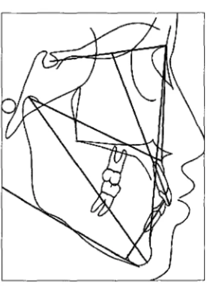 Fig. 1 Cephalometric landmarks