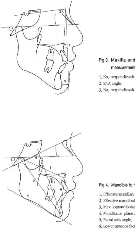 Fig 3. Maxilla and mandible to cranial base  measurements.