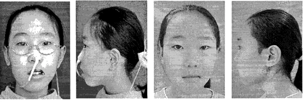 Fig 3Case 1