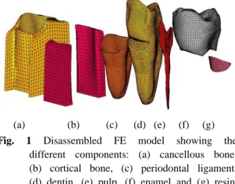 Fig. 3 Loding condition(   ≃  ,    ≃  )