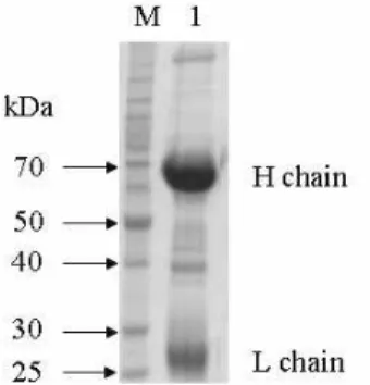 Fig.  1.  SDS-PAGE  patterns  of  egg  yolk  antibody  (IgY)  puri- puri-fied  by  PEG  (A)  method