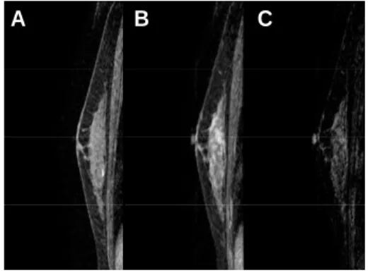 Fig.  10.  45-year-old(female)  volunteer. 