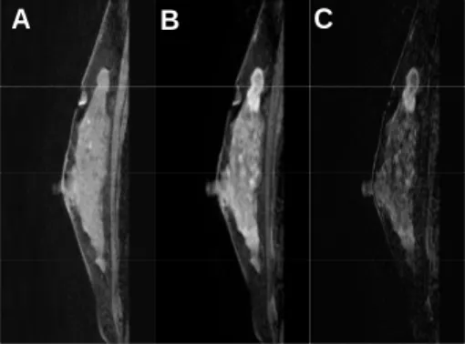 Fig.  11.  45-year-old(female)  volunteer. 