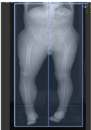 Fig.  1.  Scan  coverage  of  low  extremity CT  angiography
