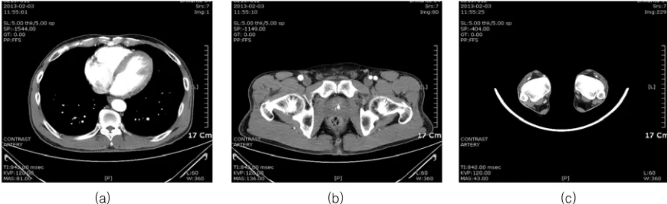 Fig.  2.  Images  of  new  protocol.  mAs  values  of  these  images    are  shown  in  the  lower  left-hand  corner.