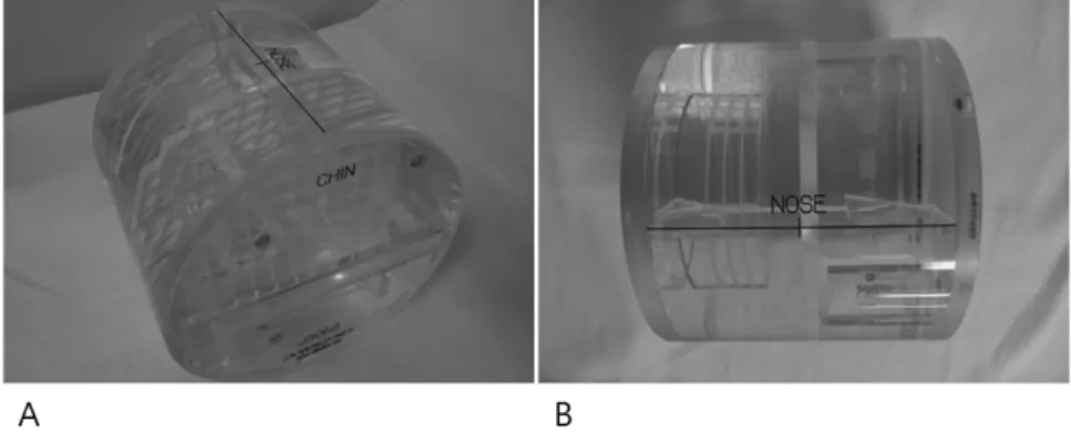 Fig.  1.  Oblique(A)  and  lateral(B)  view  of  the  ACR  MRI  phatom
