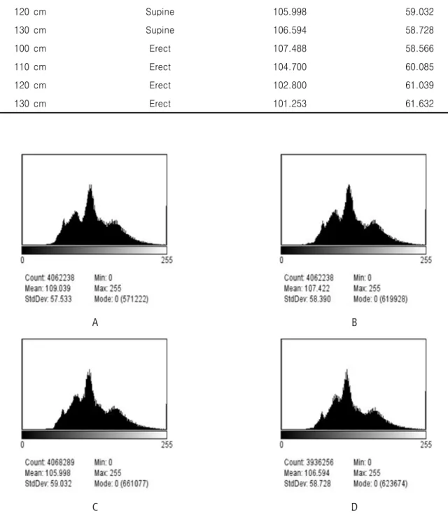 Fig.  4.  Distribution  of  the  histogram  according  to  the  change  SID  in  supine  position.