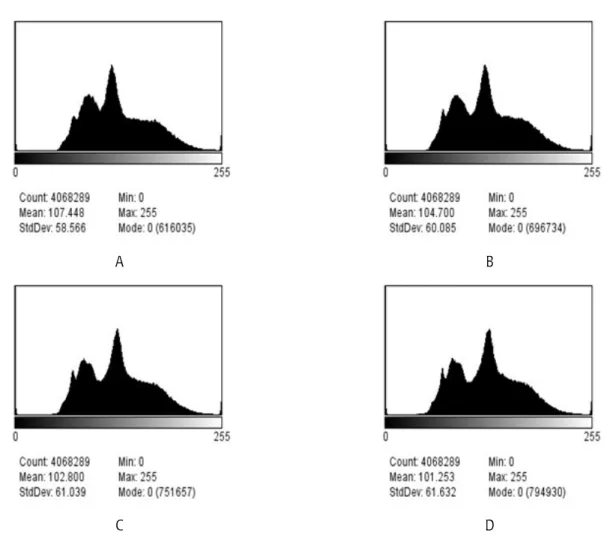 Fig.  5.  Distribution  of  the  histogram  according  to  the  change  SID  in  erect  position.