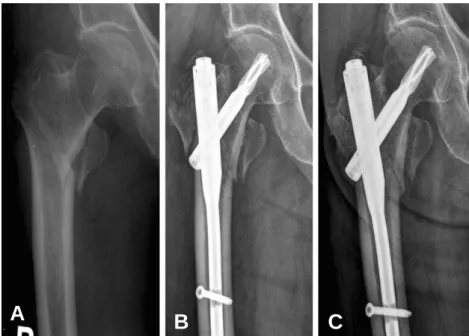 Table 3. Postoperative Complication