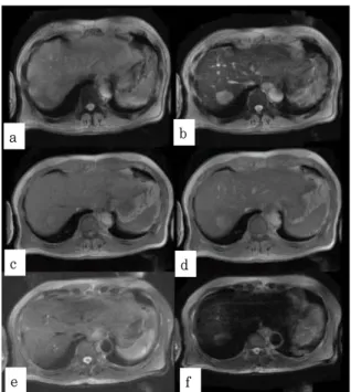 Fig.  3.  T2-GRE,  In-phase,  FS-T2-  FSE-RT  조영제  주입  전(a,  c,  e),  후(b,  d,  f)의  영상.