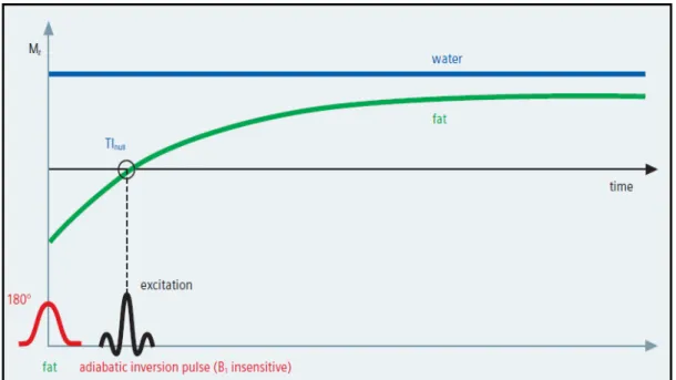 Fig. 2 . Spectral Attenuated Inversion-recovery
