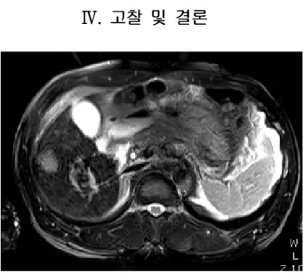Table 1 T2 Abdomen (Axial
